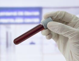 A gloved hand holds up a vial of blood.